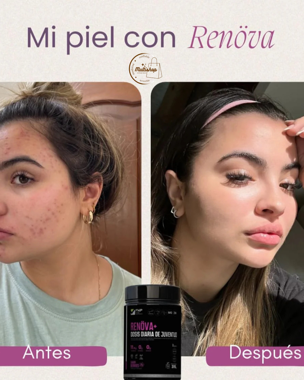 COLAGENO RENOVA +  CON  RESVERATROL 🍇